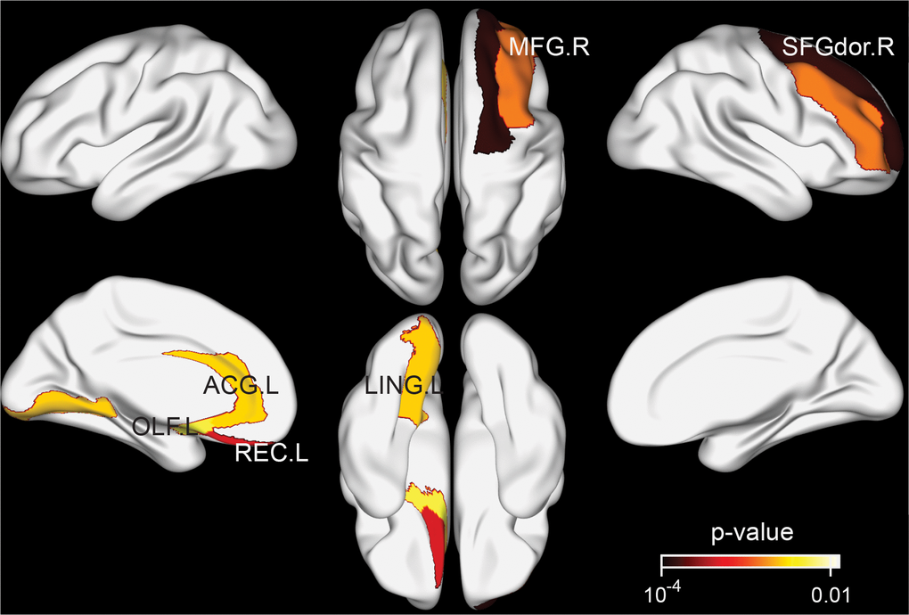 Brain regions exhibiting significant differences in structural nodal efficiency between the tea drinking group and the non-tea drinking group at the significance level of 0.01 (uncorrected) statistical evaluated by a permutation test.