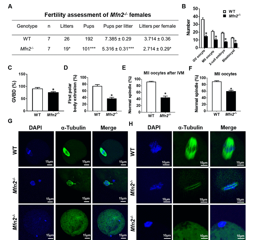 Subfertility, and impaired follicle, oocyte and embryo development in Mfn2-/- mice. (A) Fertility of female Mfn2-/- (oocyte-specific Mfn2 knockout, Mfn2fl/fl/Zp3-Cre, referred to as Mfn2-/-) and WT mice (8-week-old, n = 7 for each genotype) was assessed by mating with WT males of proven fertility (male/female; 1:2) for 12 weeks. Mfn2-/- mice had smaller litter size (pups per litter) and litters per female compared with WT females. (B) Number of GV oocytes, MII oocytes, 2-cell embryos and blastocysts in Mfn2-/- and WT mice. (C, D) Oocytes at GV stage were collected from PMSG-primed Mfn2-/- and WT mice and analyzed after 18 h of culture under in vitro maturation conditions. Percentages of GVBD and of first polar body extrusion in Mfn2-/- and WT oocytes are shown. (E, G) After 18 h of IVM, Mfn2-/- and WT MII oocytes were stained with α-tubulin and DAPI. Left column, DAPI (blue); middle column, anti-α-tubulin antibody (green); right column, merged images of DAPI and anti-α-tubulin staining. Percentages of normal spindle morphology in Mfn2-/- and WT MII oocytes after IVM are shown. (F, H) Mature (MII) oocytes were collected from the oviducts of superovulated 8-week-old Mfn2-/- and WT mice and stained with α-tubulin and DAPI. Percentages of normal spindle morphology in Mfn2-/- and WT MII oocytes are shown. Data presented as mean ± SEM. *p p t-test.