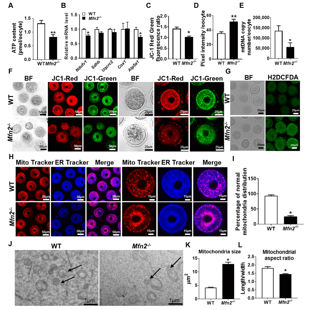 Mitochondrial function is impaired in Mfn2-/- oocytes. (A) ATP measurement in Mfn2-/- and WT mice GV stage oocytes. (B) mRNA expression of respiratory chain genes was assessed using qRT-PCR in GV stage oocytes collected from Mfn2-/- and WT mice. (C, F) Representative fluorescent micrographs of GV stage oocytes stained by mitochondria JC-1. Red fluorescence represents J-aggregate while green fluorescence represents JC-1 monomer. Mitochondrial membrane potential is indicated by the red/green fluorescence intensity ratio. (D, G) Fluorescence intensity of Carboxy-H2DCFDA was used to measure ROS levels after treatment with H2O2. (E) mtDNA copy number was determined by qRT-PCR in GV stage oocytes collected from Mfn2-/- and WT mice. (H) Mitochondria and ER were labeled by immunostaining with MitoTracker (red) and ER-Tracker (blue). (I) The percentages of oocytes with normal distribution of mitochondria in the Mfn2-/- and WT mice. (J) Representative electron microscopic graphs of oocytes from 8-week-old Mfn2-/- and WT mice (n=3 ovary from different mice assessed in each group). Arrows show mitochondria. (K, L) Mitochondrial size and aspect ratio in Mfn2-/- and WT oocytes. Data presented as mean ± SEM. *p p t-test. ATP: Adenosine triphosphate. Ndufv1: NADH dehydrogenase (ubiquinone) flavoprotein 1; Sdhb: succinate dehydrogenase complex iron sulfur subunit B; Uqcrc2: ubiquinol cytochrome c reductase core protein 2; Cox1: cytochrome c oxidase subunit I; Atp5a1: ATP synthase, H+ transporting, mitochondrial F1 complex, alpha subunit 1.