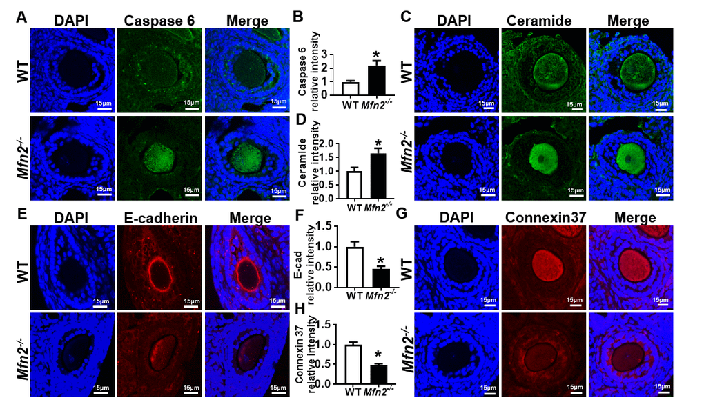 Increased apoptosis in Mfn2-/- secondary follicle-enclosed oocytes is associated with increased ceramide and decreased junction protein expression. (A, C) Immunofluorescence staining of caspase-6 (green) and ceramide (green) in secondary follicles of Mfn2-/- and WT mice ovaries. DAPI was used to stain nuclei (blue). (B, D) Quantitative analysis of caspase-6 and ceramide immunofluorescence in secondary follicles of Mfn2-/- and WT mice ovaries. (E, G) Immunofluorescence staining of E-cadherin (red) and Connexin37 (red) in secondary follicles of Mfn2-/- and WT mice ovaries. (F, H) Quantitative analysis of E-cadherin and Connexin37 immunofluorescence in secondary follicles of Mfn2-/- and WT mice ovaries. Data presented as mean ± SEM. *p t-test.