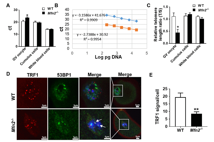 The telomere is shorter in Mfn2-/- oocyte. (A) Ct values from quantitative real-time PCR (qRT-PCR) of GV oocytes, cumulus cells and white blood cells form Mfn2-/- and WT mice. (B) Standard curves were generated by serial dilution of known amounts of DNA to calculate relative DNA concentrations (log DNA) from Ct values of the qRT-PCR products. Orange squares, telomeres; blue diamonds, 36B4 single copy gene control. The correlation regression equation and coefficients (R2) of Ct versus log DNA are shown. (C) The relative telomere length of GV oocytes, cumulus cells and white blood are represented as ratio of T/S. (D) Immunofluorescence double staining of 53BP1 (green) and TRF1 (red) in cumulus oophorus complexes of Mfn2-/- and WT mice. DAPI was used to stain nuclei (blue). (E) Quantitative analysis of TRF1 immunofluorescence in Mfn2-/- and WT GV oocytes. The arrow showed the co-localization of 53BP1 and TRF1. Data presented as mean ± SEM. **p p t-test.