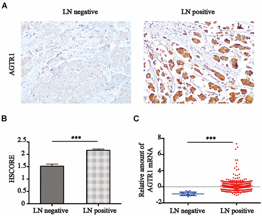 AGTR1 expression is associated with lymph node metastasis. (A) Representative images of AGTR1 expression in lymph node-negative or -positive tissues by IHC. (B) HSCORE of AGTR1 protein expression in breast cancer tissues from lymph node-positive or lymph node-negative patients. *** P0.001. (C) Relative amount of AGTR1 mRNA in cancer tissues from lymph node-positive or -negative patients in the Oncomine database. *** P0.001.