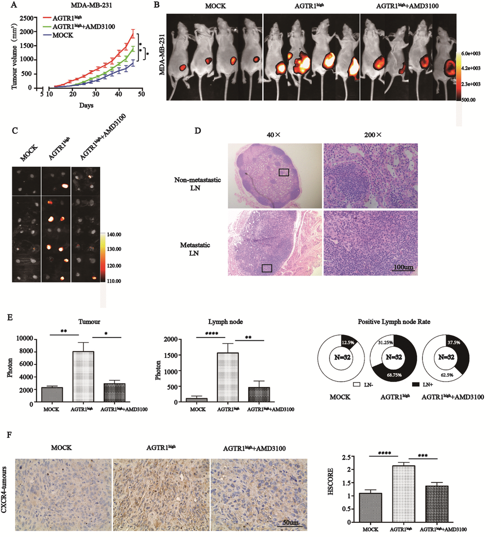 AGTR1 contributes to lymph node metastasis via CXCR4. (A) Growth curve of subcutaneous xenografts with MOCK and AGTR1high-MDA-MB-231 cells in nude mice. AMD3100 was administrated i.p. 14 days after implanting AGTR1high-MDA-MB-231 tumors. * PP0.01. (B) and (C) Representative images of xenograft models and lymph nodes are shown by BLI; n=8. (D) Representative HE staining figures of non-metastatic or metastatic lymph nodes in 4T1 mice. (E) Quantification of the signal intensities of tumors and lymph nodes and rates of lymph node metastasis in MDA-MB-231 tumors. * P0.05, ** P0.01, **** PF) Representative xenograft tissues in three groups, which were subjected to immunohistochemical staining with anti-CXCR4. HSCORE of CXCR4 protein expression in mouse tumor tissues. * P0.05, **** P