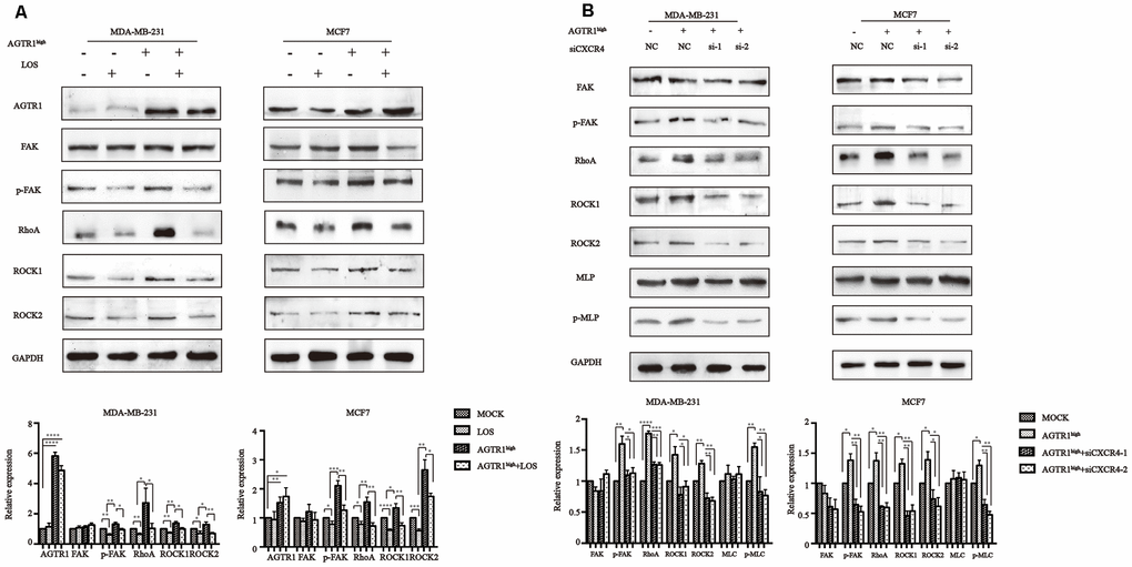 The instrumental role of CXCR4 in AGTR1-mediated cell migration through the FAK/RhoA pathway. (A) Effects of LOS and AGTR1 on the expression of FAK, p-FAK, RhoA, ROCK1, and ROCK2 analyzed through Western blotting. Representative images and protein bond intensities are provided in the bottom panel. * P0.05, ** P0.01, *** PPB) Effects of CXCR4 knockdown on the expression of FAK, p-FAK, RhoA, ROCK1, ROCK2, MLC and p-MLC in AGTR1high cells, as determined by Western blotting. Representative images and protein bond intensities are provided in the bottom panel. * P0.05, ** P0.01, *** PP