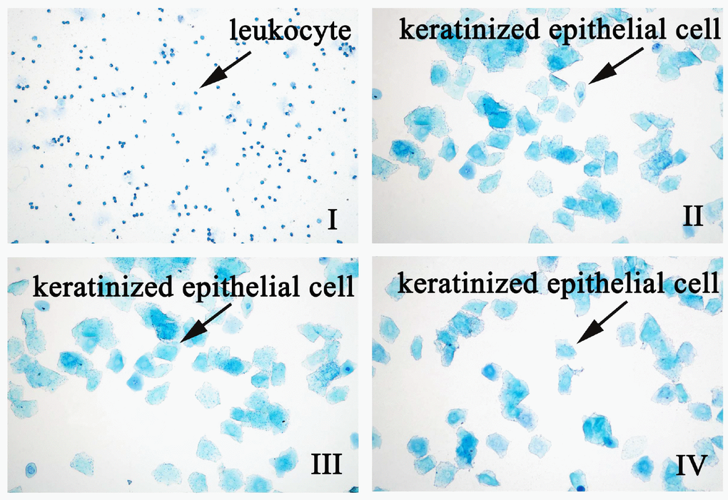 The effect of QYFE on the estrous cycle in ovariectomized (OVX) rats. EV refers to estradiol valerate, QYFE to Qing Yan Formula 70% ethanol extract. Representative photomicrographs taken at 200-X magnification. (I) OVX rats untreated; (II) Shan; (III) OVX rats treated with estradiol valerate (EV); (IV) OVX rats treated with 2.8g/kg QYFE.