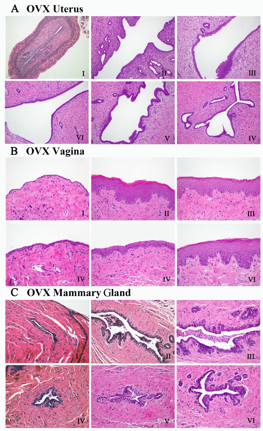 The effects of QYFE treatment on the histology of uterus, vagina and mammary gland in the OVX rats. Representative photomicrographs taken at 200-X magnification of uterine, 400-X magnification of vaginal and mammary gland sections in ovariectomized (OVX) rats. (A–C) are the histology of the uterus, vagina and mammary gland, respectively in OVX rats. The treatment groups in OVX rats are shown: (I) Untreated ovariectomized (OVX) rat; (II) sham-operated rat; (III) OVX rat treated with estradiol valerate (EV); and OVX rat treated with (IV) 0.7 g/kg, (V) 1.4 g/kg, and (VI) 2.8 g/kg QYFE.