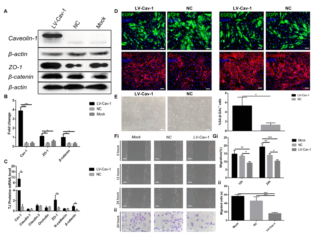 Overexpression of Caveolin-1 induced ARPE-19 cell senescence and inhibited migration and invasion. (A) Western blot analyses showed that overexpression of Caveolin-1 upregulated Zo-1 and β-catenin; β-actin was used as the loading control. (B) Western blot results were quantified by densitometry, and the results are expressed as a ratio with β-actin. Data are presented as means ± SD; * indicates a p value p value p value C) qPCR analyses showed that overexpression of Caveolin-1 upregulated Zo-1 and β-catenin. Data are presented as means ± SD; * indicates a p value D) Expression of EGFP, Zo-1 and β-catenin was assessed by immunoﬂuorescence in Caveolin-1-overexpressing RPE cells and negative-control RPE cells. (E) Representative microscopic images of β-galactosidase staining in RPE cells showed overexpression of Caveolin-1 in RPE cells compared with that in negative-control RPE cells. Quantification of percentage of cells with positive SA-β-gal staining.Data are presented as means ± SD; * indicates a p value p value F) (i) Wound-healing assays in Caveolin-1-overexpressing RPE cells. (ii). Transwell invasion assays in Caveolin-1-overexpressing RPE cells. (G) (i) The rate of cell migration in different groups was measured at different time points. Note that cell migration was decreased in Caveolin-1-overexpressing RPE cells. (ii) The mean number of invaded cells was assessed in 5 fields. Note that cell invasion was decreased in Caveolin-1-overexpressing RPE cells. Data are presented as means ± SD; * indicates a p value p value p value 