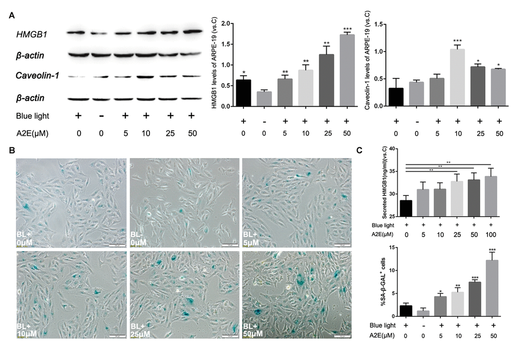 Blue light exposure of A2E-treated ARPE-19 cells increased HMGB1 and Caveolin-1 expression. (A) Western blot assay for HMGB1 and Caveolin-1 in RPE cells treated with a concentration gradient of A2E with or without blue light, quantified by densitometry, and the results are expressed as a ratio with β-actin. Data are presented as means ± SD; * indicates a p value p value B) Representative microscopic images of β-galactosidase staining in RPE cells with various concentrations of A2E. Quantification of percentage of cells with positive SA-β-gal staining.Data are presented as means ± SD; * indicates a p value p value C) The release of HMGB1 induced by A2E treatment were detected by ELISA assays.