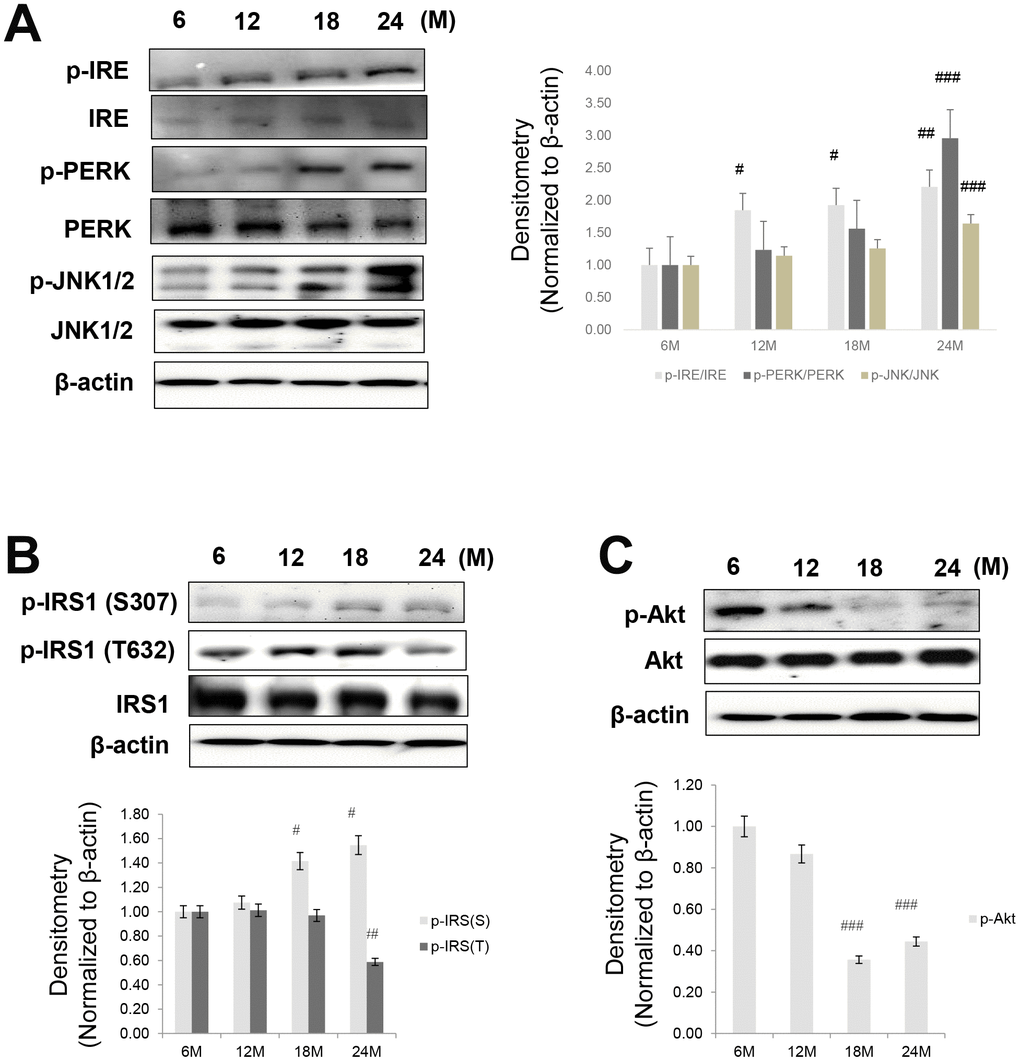 Aging-related increase in ER stress and insulin signaling. Western blotting was performed to detect the protein level of factors involved in ER stress, insulin signaling, and Akt signaling. (A) ER stress markers (p-IRE, IRE, p-PERK, PERK, p-JNK, and JNK) (B) insulin signaling factors (pSer-IRS1, pTyr-IRS1, IRS1) (C) aging-related increase in phospho-Akt level. β-actin was the loading control of the cytosolic fractions. Results of one-factor ANOVA: #p ##p ###p 