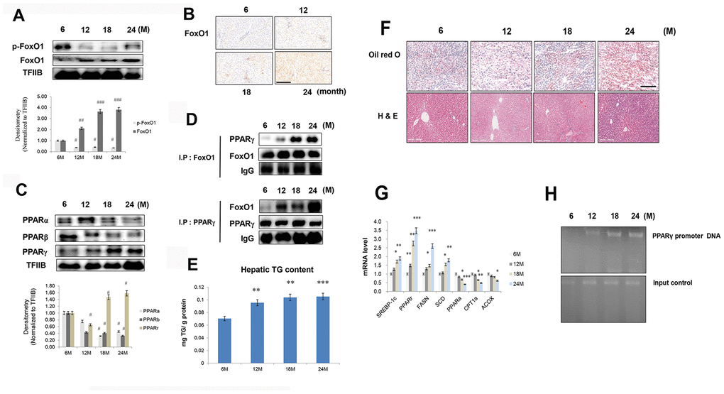 Aging-related increase in FoxO1-induced lipid accumulation. (A) Western blotting was performed to examine the protein levels of p-FoxO1 and FoxO1 in the liver of aging rats. Results of one-factor ANOVA: ##p ###p B) Immunohistochemical staining for FoxO1 in aging liver. Scale bar: 200 μm. (C) Western blotting analysis of PPARs in the nuclear of aging liver. TFIIB was the loading control of the nuclear fraction. One representative result of the three experiments for each protein is shown. Results of one-factor ANOVA: #p D) Western blotting showed that immunoprecipitated FoxO1 and PPARγ were physically associated with PPARγ and FoxO1, respectively. (E) Hepatic TGs in aging rats. Results of one-factor ANOVA **p ***p F) Aging livers were stained with Oil red O to visualize lipid accumulation. Scale bar: 100 μm. Representative H&E staining shows increased vacuoles in liver tubules during aging. Scale bar: 300 μm. (G) Real-time PCR analyses was performed for measuring the mRNA levels of SREBP-1c, PPARγ, FASN, SCD, PPARα, CPT1α, and ACOX. The data are expressed as a mean ± SEM. *p **p ***pH) FoxO1 binds to the PPARγ promoter in aging livers. The livers were subjected to ChIP assay by using rabbit pre-immune IgG and an anti-FoxO1 antibody. Immunoprecipitates were subjected to PCR by using rat PPARγ promoter DNA.