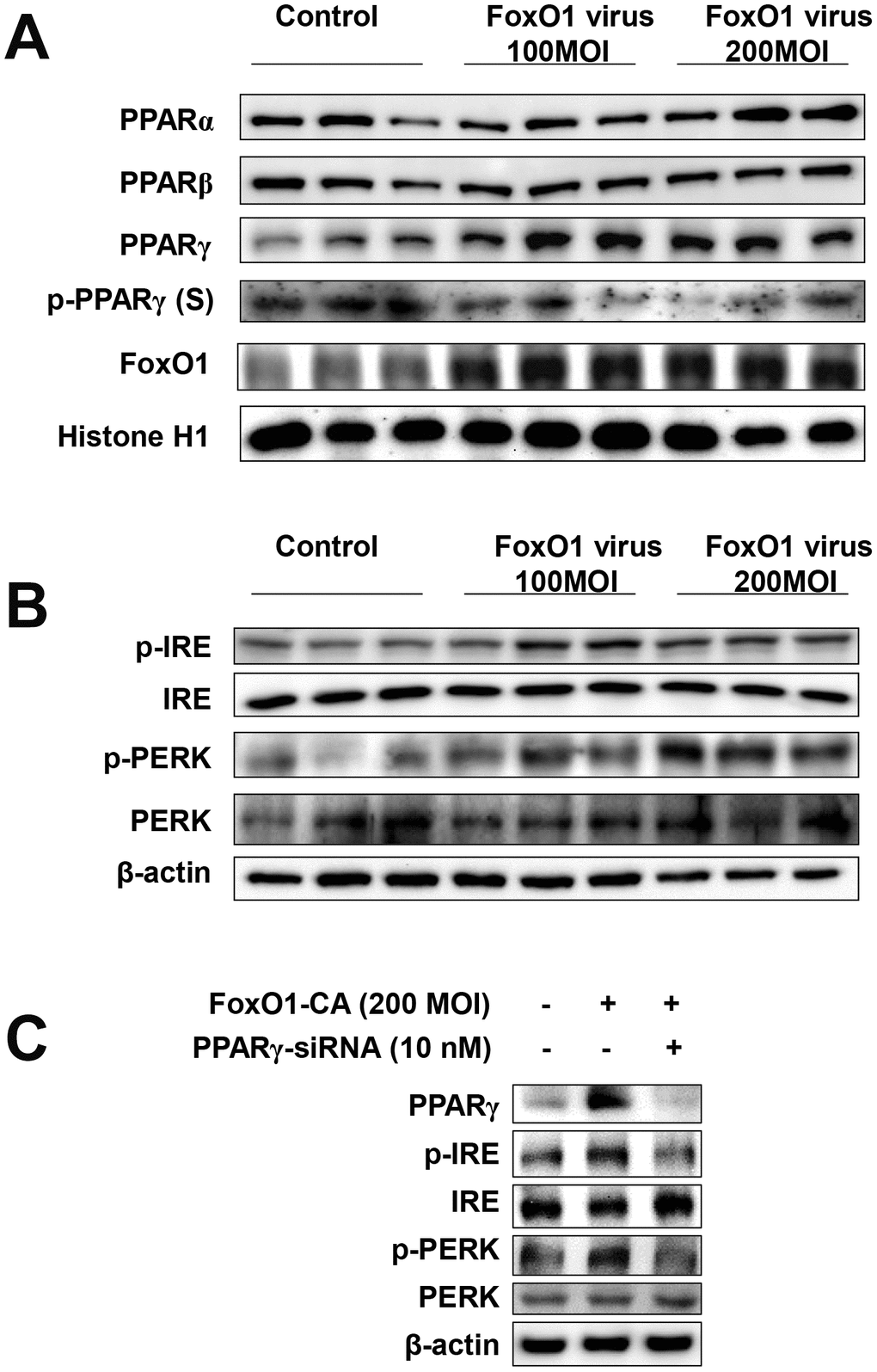 FoxO1 regulates ER stress through PPARγ in FoxO1-virus treated cells. (A) Activation of PPARγ by FoxO1. AC2F cells were grown to 80% confluence in 100 mm dishes in DMEM, and then stimulated with 100 and 200 MOI FoxO1 and analyzed by western blotting using the appropriate antibody. (B) FoxO1-induced activation of ER stress genes. Western blot was used to detect p-IRE, total-IRE, p-PERK, and total-PERK in cytoplasmic extracts (20 μg protein) from AC2F cells. (C) AC2F cells were grown to 80% confluence in 100-mm dishes containing DMEM, pretreated (one day) with or without PPARγ-siRNA (10 nM), then stimulated with the FoxO1 virus (200 MOI) for 1 days, and Western blot was used to detect PPARγ, p-IRE, total-IRE, p-PERK, and total-PERK in cytoplasmic extracts (20 μg protein) by using the β-actin as a control from AC2F cells.
