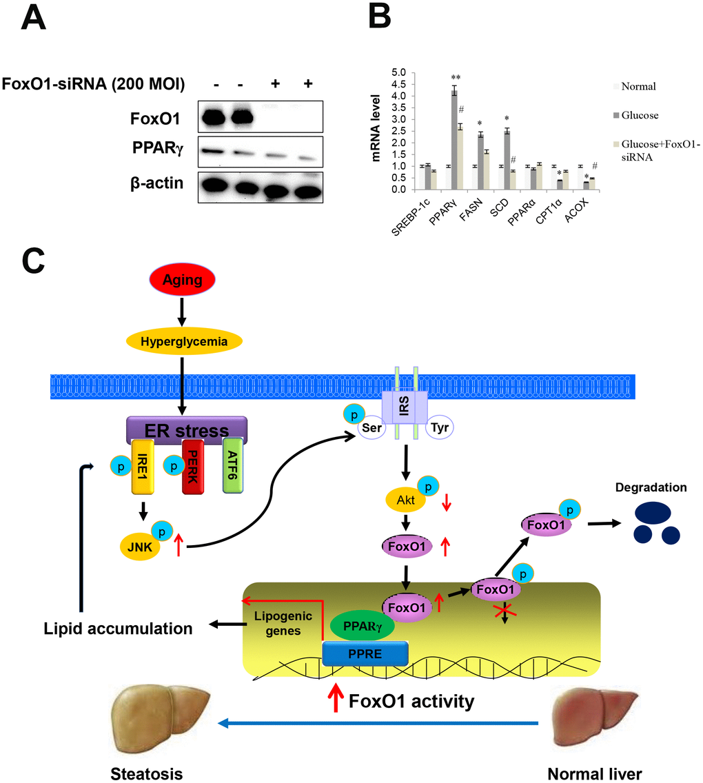 Effect of high glucose and FoxO1 deletion on the regulation of lipid metabolism. (A) Western blot was used to detect FoxO1 and PPARγ in FoxO1-siRNA treated liver cells. β-actin was used as a loading control. (B) The expression of SREBP-1c, PPARγ, FASN, SCD, PPARα, CPT1, and ACOX was analyzed by qPCR after treatment with glucose (30 mM) for 24 h in FoxO1-siRNA transfected (200 MOI) cells. The results were normalized based on the actin level. (C) Possible mechanism by which FoxO1 activates ER stress-induced lipogenesis in aging.
