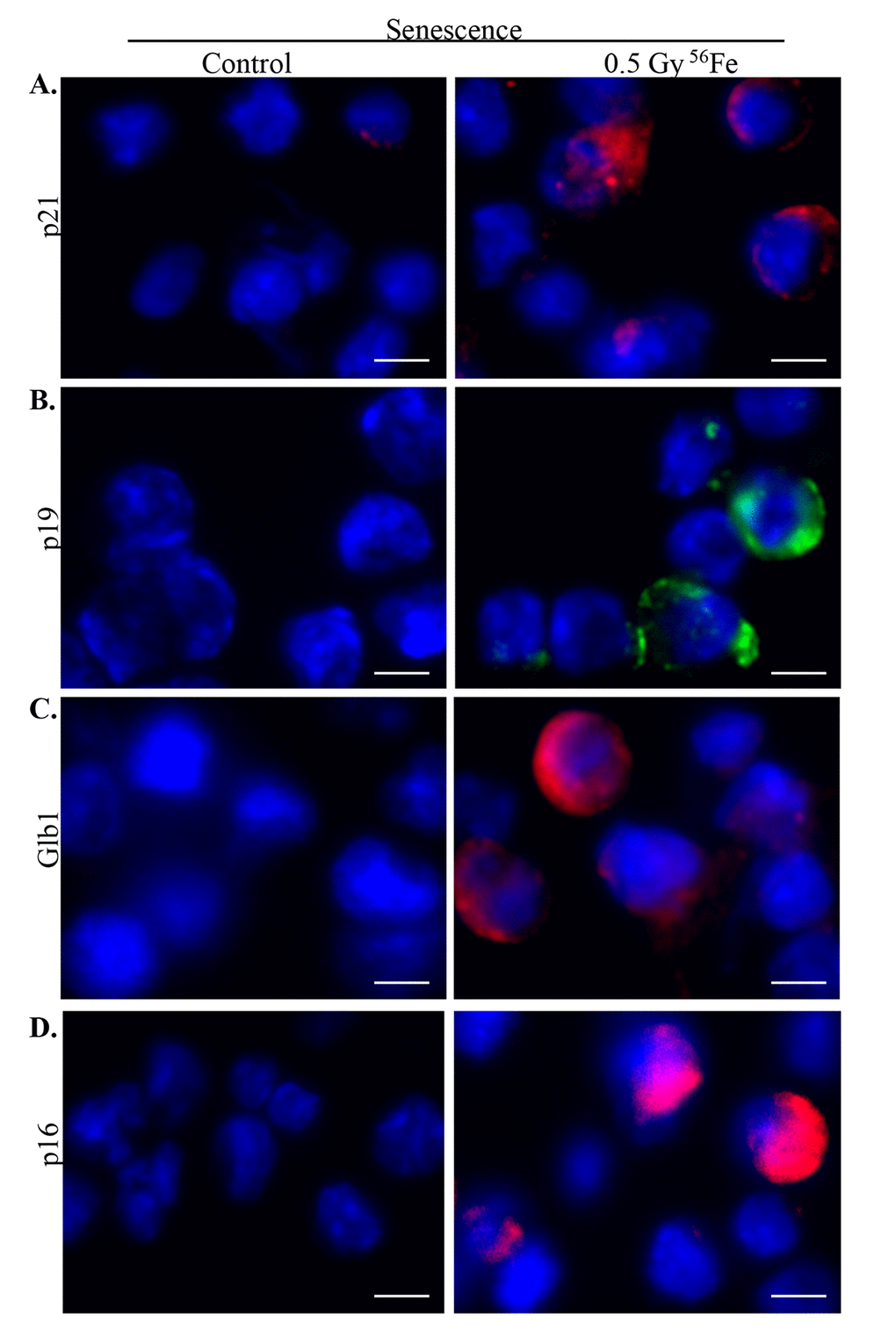 Increased senescence in murine ISCs after heavy ion radiation exposure. (A) Representative IF images showing increased p21 expression in ISCs from heavy ion radiation exposed mice. (B) Increased p19 expression in ISCs from heavy ion radiation exposed mice. (C) ISC sections immunofluorescently stained for Glb1 show increased staining in irradiated samples. (D) Representative IF images showing increased p16 levels in ISCs from heavy ion radiation exposed mice. Scale bar, 5 μm.