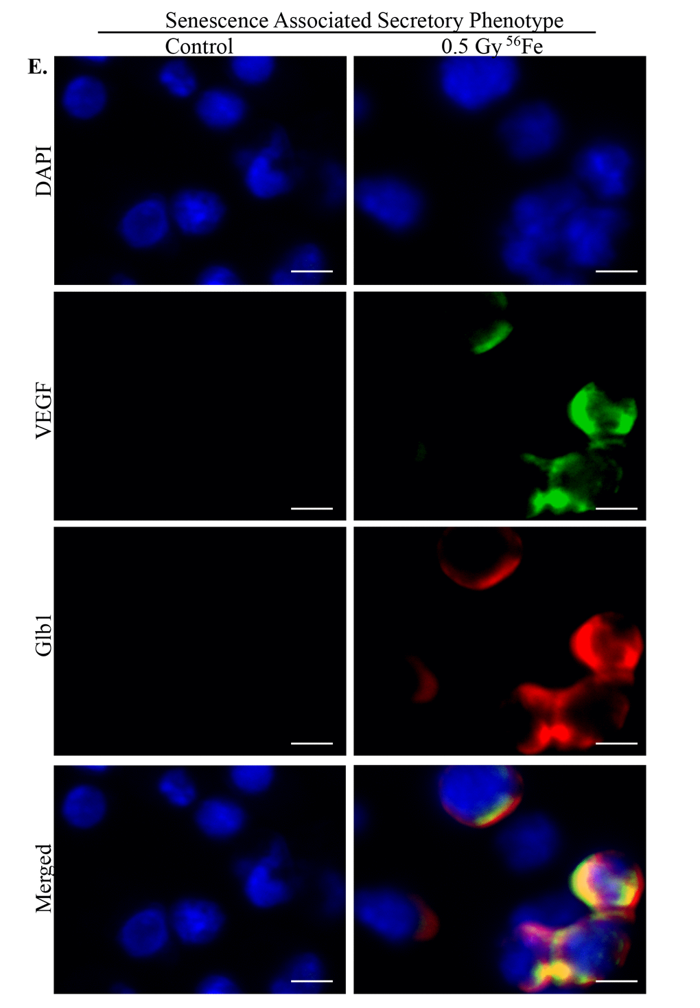 Acquisition of SASP by heavy ion radiation-induced senescent ISCs. ISC sections from control and irradiated mice were co-stained for SASP marker VEGF (green) and senescent marker Glb1 (red) showing acquisition of secretory phenotype by senescent cells after heavy ion radiation exposure. Scale bar, 5 μm.