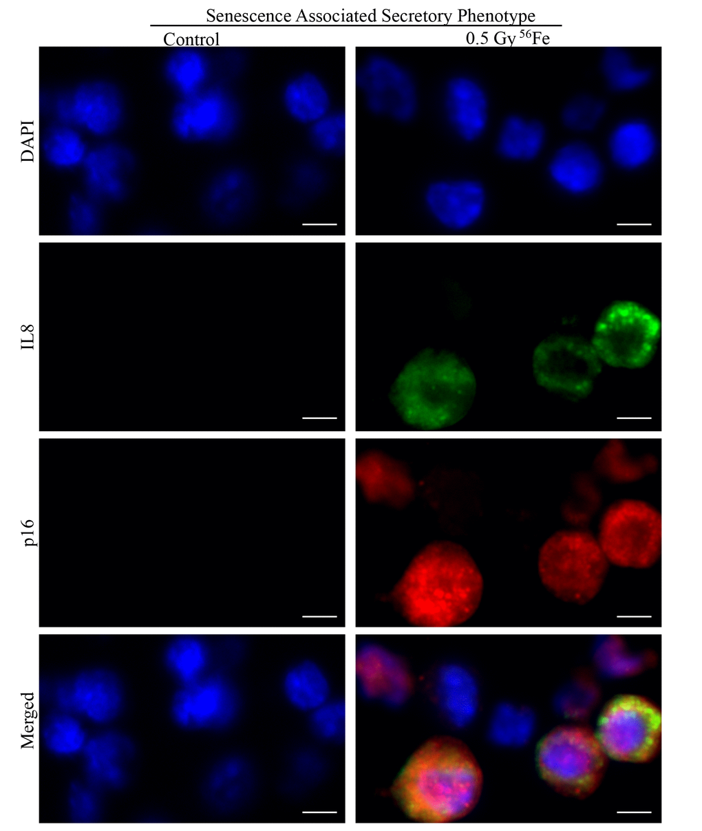Representative IF images of ISC sections co-stained for SASP marker IL8 (green) and senescent marker p16 (red) showing some of the senescent cells acquiring secretory phenotype in irradiated samples. Scale bar, 5 μm.