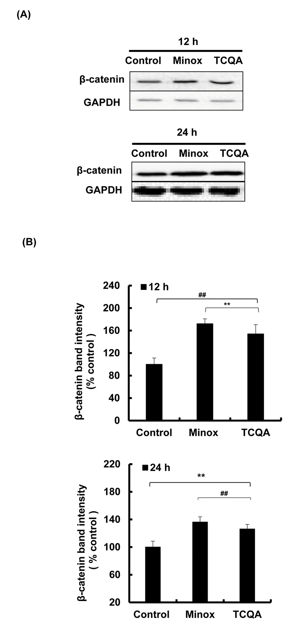 TCQA stimulated β-catenin expression in human hair follicle dermal papilla cells (HFDPCs). (A) β-catenin protein expression after 12 and 24 h treatment with 0 and 10 µM TCQA and 0.1 µM Minox. (B) Band intensities was done using LI-COR system after 12 h and 24 h treatment.