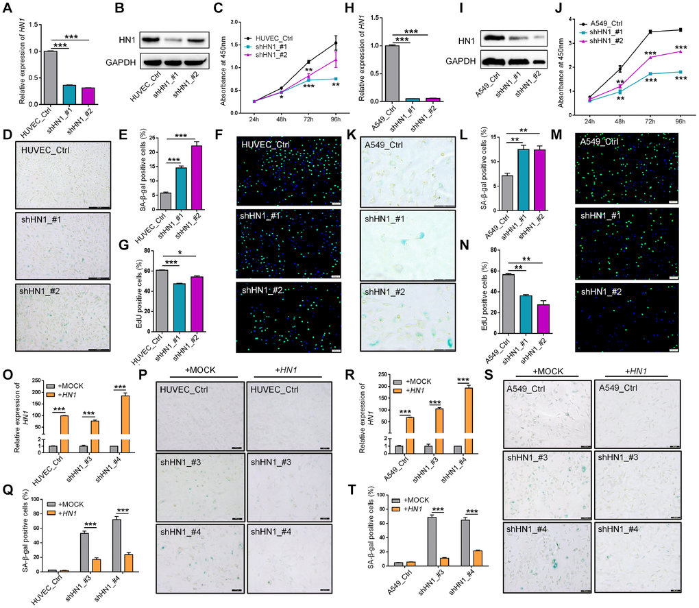 Knockdown of HN1 induces cellular senescence in normal and cancer cells. (A–B) Validation of HN1 knockdown (KD) in HUVEC with two shRNAs (shHN1