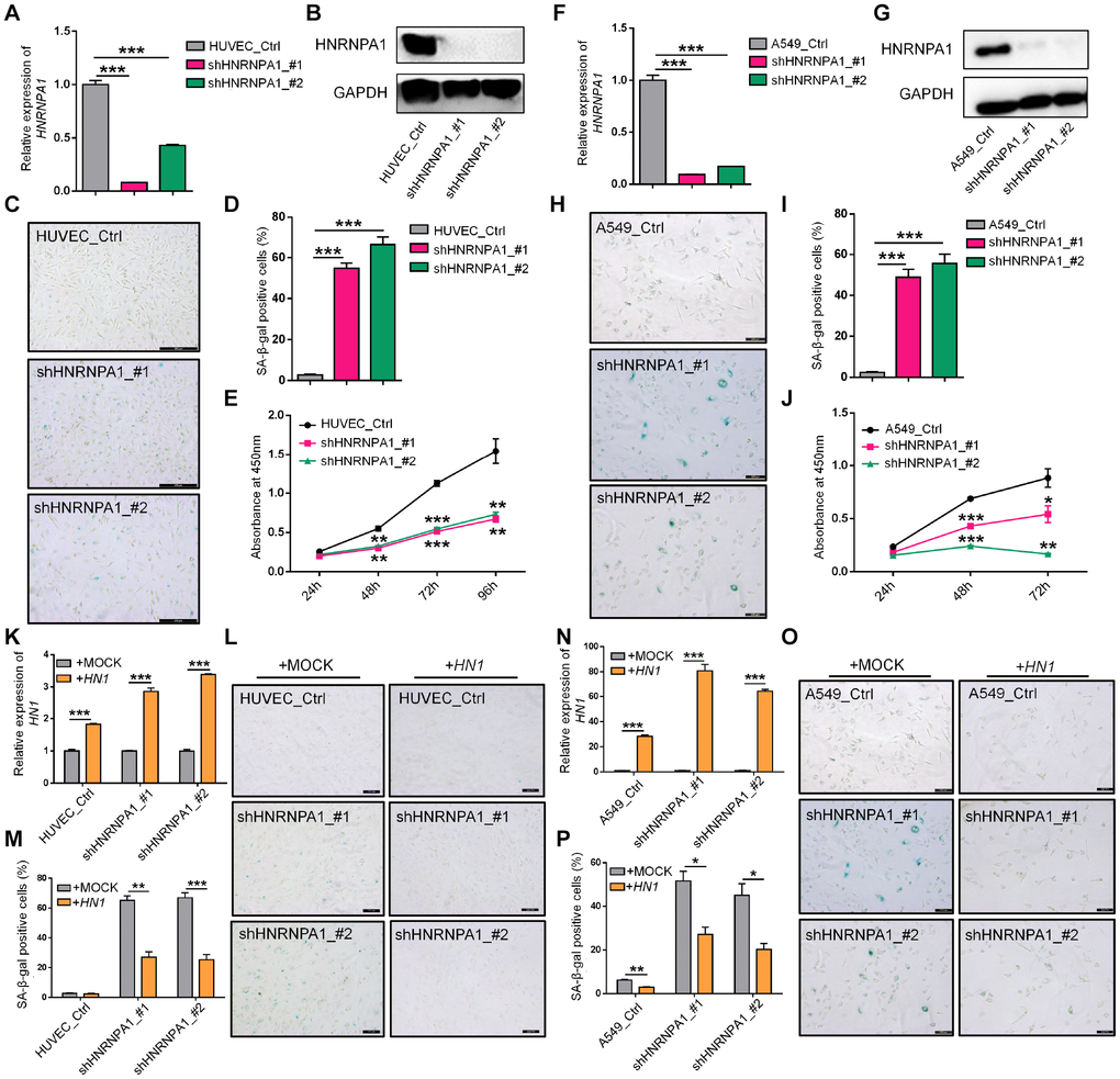 HNRNPA1 knockdown induces senescence-associated phenotypes and HN1 overexpression rescues HNRNPA1-KD induced SA-β-Gal activity. (A–E) Senescence-associated phenotypes were detected in HNRNPA1-KD HUVECs. HNRNPA1 knockdown by two shRNAs was validated by both qRT-PCR (A) and Western blot (B). *** represents p t-test with three qPCR reactions. SA-β-Gal staining positive cells increased (C, D) and cell proliferation rate decreased (evaluated by CCK-8 assay) (E) in HNRNPA1-KD cells. *** in D represents p t-test with three independent countings. ** and *** in E stand for p t-test with three biological replicates. (F–J) The same assays in panels A-E were performed in HNRNPA1-KD A549 cells, including mRNA levels (F), protein levels (G), SA-β-Gal staining (H, I), and CCK-8 assay (J), as described in panel A-E. *, ** and *** in J stand for p t-test with three biological replicates. (K–M) Overexpression of HN1 reversed HNRNPA1-KD induced SA-β-Gal staining in HUVECs. Overexpression of HN1 was confirmed in both HNRNPA1-KD and control HUVEC cells (K). *** represents p t-test with three qPCR reactions. Representative SA-β-Gal staining (L) and staining-positive cell statistics (M) in control (+MOCK) and HN1 overexpression (+HN1) HUVECs were shown. ** and *** in M stand for p t-test with three independent countings.(N–P) Overexpression of HN1 reversed HNRNPA1-KD induced SA-β-Gal staining in A549 cells. Overexpression of HN1 was confirmed in both HNRNPA1-KD and control A549 cells (N). *** represents p t-test with three qPCR reactions. Representative SA-β-Gal staining (O) and staining-positive cell statistics (P) in control (+MOCK) and overexpression (+HN1) A549 cells were shown. * and ** in P stand for p t-test with three independent countings.