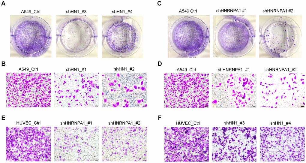 Knockdown of HN1 and HNRNPA1 inhibits ability of colony formation and cell migration. (A) The colony formation capacity between control (Ctrl) and HN1-KD (two shRNAs) A549 cells was detected by crystal violet staining. (B) Cell migration ability in HN1-KD (two shRNAs) A549 cells was detected by transwell assay. (C–D) The ability of colony formation (C) and cell migration (D) was weakened in HNRNPA1-KD (two shRNAs) A549 cells. (E–F) Cell migration ability was weakened in HNRNPA1-KD (E, two shRNAs) and HN1-KD HUVECs (F, two shRNAs) when comparing to control cells, as evaluated by transwell migration assay.