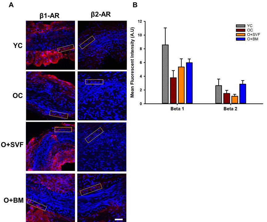 β1- and β2-AR immunofluorescence in isolated coronary arterioles. Representative images with ROI boxes used for fluorescent intensity analysis are shown on isolated coronary arterioles stained for β1- or β2-AR (A). There is no significant difference between the groups in the expression of β1- or β2-AR as measured by quantification of fluorescent intensity (B). Data are represented as means+SEM and analyzed with one-way ANOVA (n≥4). Scale bar is 50 micrometers.