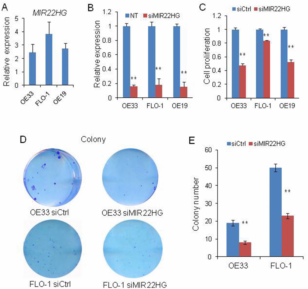 Effects of knockdown of MIR22HG on EAC cells viability. (A) relative expression of MIR22HG in OE33, FLO-1 and OE19 cell lines. (B) The MIR22HG expression level indicating the knockdown efficiency of siRNA determined by qRT-PCR in 3 EAC cells transfected with siMIR22HG. (C) WST-1 assays were used to determine the cell viability after MIR22HG knockdown with siRNA in OE33, FLO-1 and OE19 cells. (D), Colony formation in OE33 and FLO1 cells after MIR22HG knockdown. (E) Bar chart counting the number of colonies from Figure 1D. Values represented the mean ± s.d. from three independent experiments. **P 