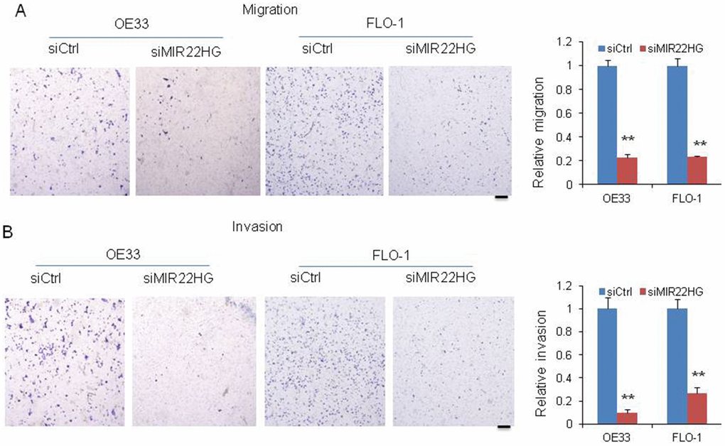 Knockdown of MIR22HG inhibits cancer cell migration and invasion. Migration (A) and invasion (B) were decreased after MIR22HG siRNA transfection in OE33 and FLO-1 cells. The bar chart shows the relative number of migration and invasion cells. Scale bar: 5mm. Values represented the mean ± s.d. from three independent experiments. *P 