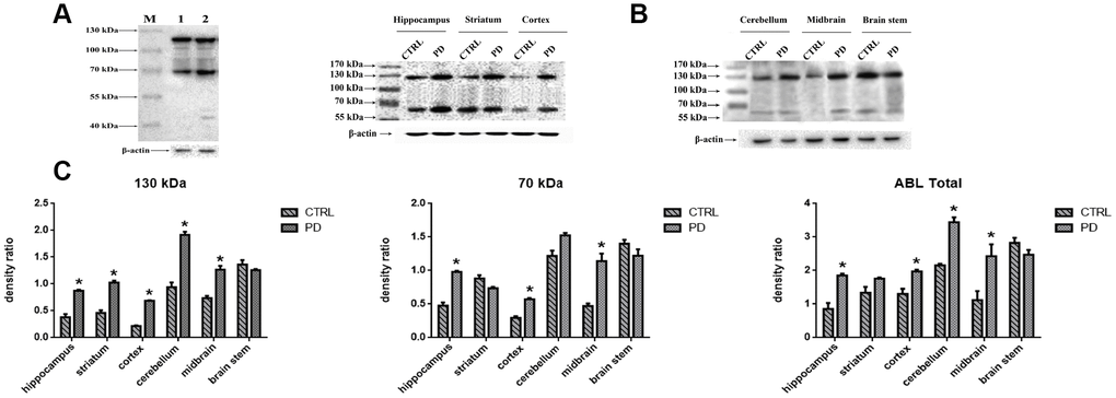 Detection of altered protein glycosylation in various mouse brain areas. (A) Western blot analysis of protein glycosylation in whole brain using ABL, which selectively labels Gal-(β-1,3)-GalNAc oligosaccharides: lane 1, control; lane 2, PD. (B) Western blot analysis of protein glycosylation in the indicated brain areas. (C) Densitometric analysis of Gal-(β-1,3)-GalNAc oligosaccharides levels normalized to the level of β-actin. Bars represented the mean±SD; * p
