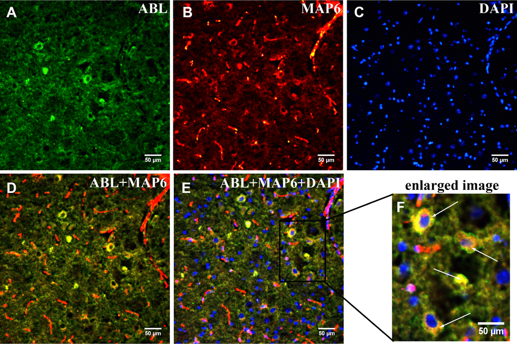 Dual immunofluorescence analysis of MAP6 glycosylation in brainstems from MPTP-induced mice. Photomicrographs show co-localization of MAP6 (A; red) and ABL (B; green). Nuclei are stained with DAPI (blue). Merged images show their colocalization (MAP6+ABL) (C and D; yellow). White arrows point to MAP6 with a glycoprotein. The enlarged image is the boxed part in the merged image.