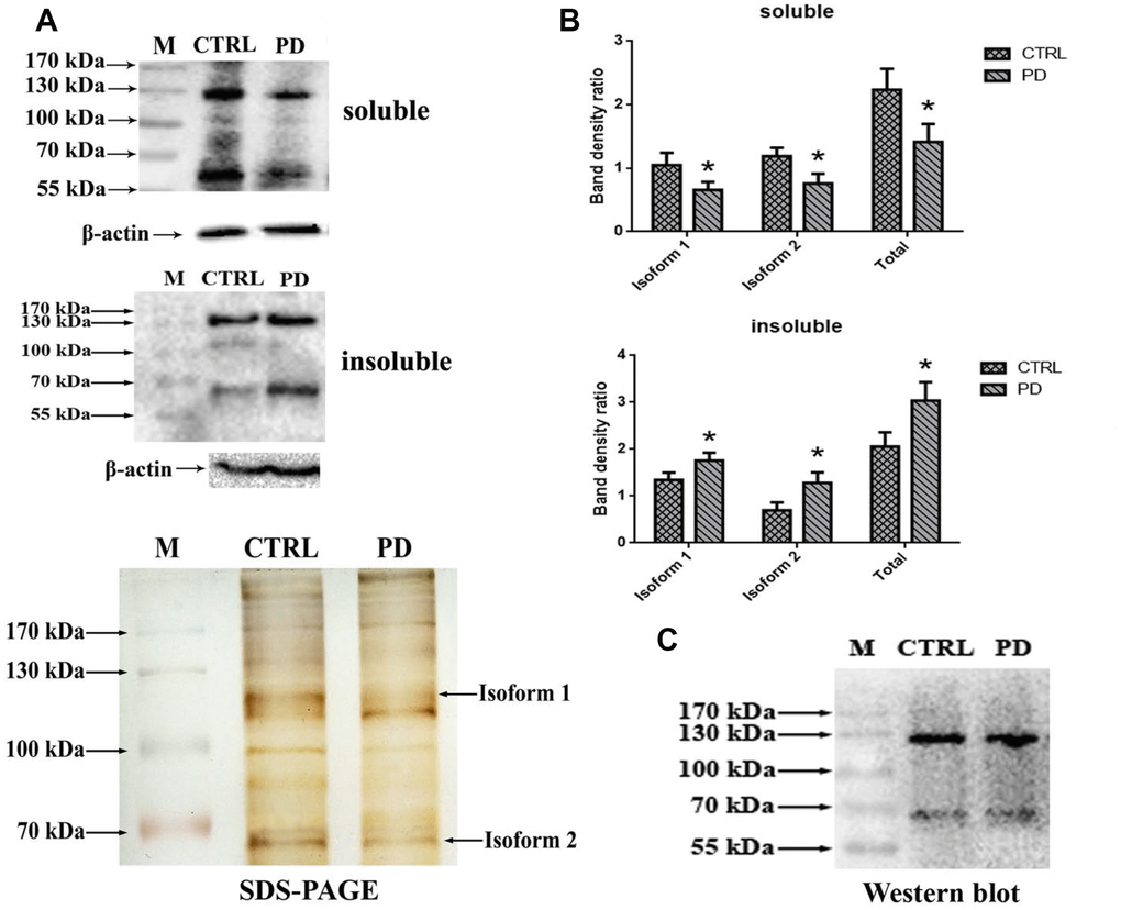 Confirmation glycoprotein of interest is MAP6. (A) Western blot analysis of soluble lysates and insoluble precipitates. M, protein size standards. (B) Densitometric analysis of MAP6 levels normalized to the level of β-actin in soluble lysates and insoluble precipitates. Bars depict the mean±SD; * pC) Blots showing that MAP6 is a glycoprotein containing Gal-(β-1,3)-GalNAc oligosacchrides. Immunoprecipitation was coupled with Western blot analysis of extract from the whole mouse brain. The SDS-PAGE gel was visualized using silver-staining kit; and the membrane of WB was blotted with ABL, and visualized using a ECL kit.