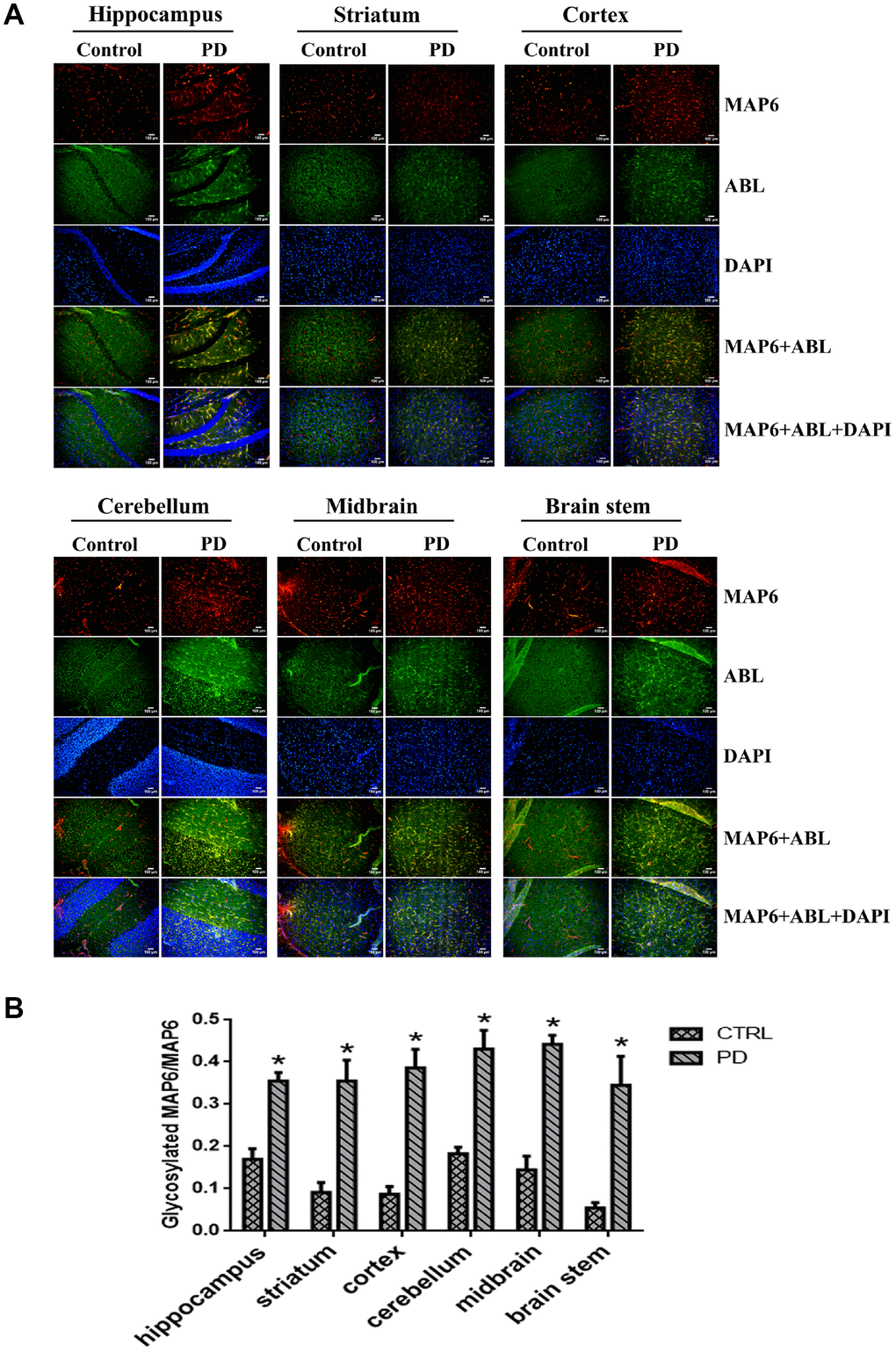 In situ dual immunofluorescence analysis glycosylated MAP6 in various brain areas in PD mice. (A) Representative photomicrographs of immunofluorescent labeling of glycoproteins detected by ABL (green) and MAP6 stained using anti-MAP6 monoclonal antibody (red) in the indicated areas, as well as their colocalization (yellow). Nuclei were stained using DAPI (blue). (B) Statistical comparison of the immunofluorescent signals between the MPTP-induced PD mice and control mice. Bars depict the mean±SD; *p