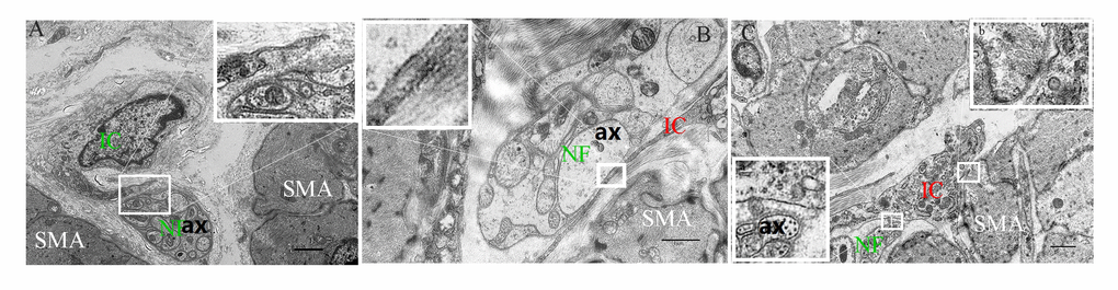 The intimate relationship between the nerve trunk and the ICs in the muscle layer of 5-day (A), 40-day (B) and 70-day (C) groups, respectively. Higher magnification views of the square frame in (A). The IC projections were close to the nerve trunk in the 5-day group. Higher magnification views of the square frame in (B), the close connection between the axon and the IC projection. Higher magnification views of the square frames in (C). The close connection not only between the axon and the IC projection (a), but between the muscle and the IC soma (b). IC, interstitial cells; NF, nerve fibers; SMA, Smooth muscle; ax, axon. (Bar = 2μm in A, Bar = 1μm in B,C.)