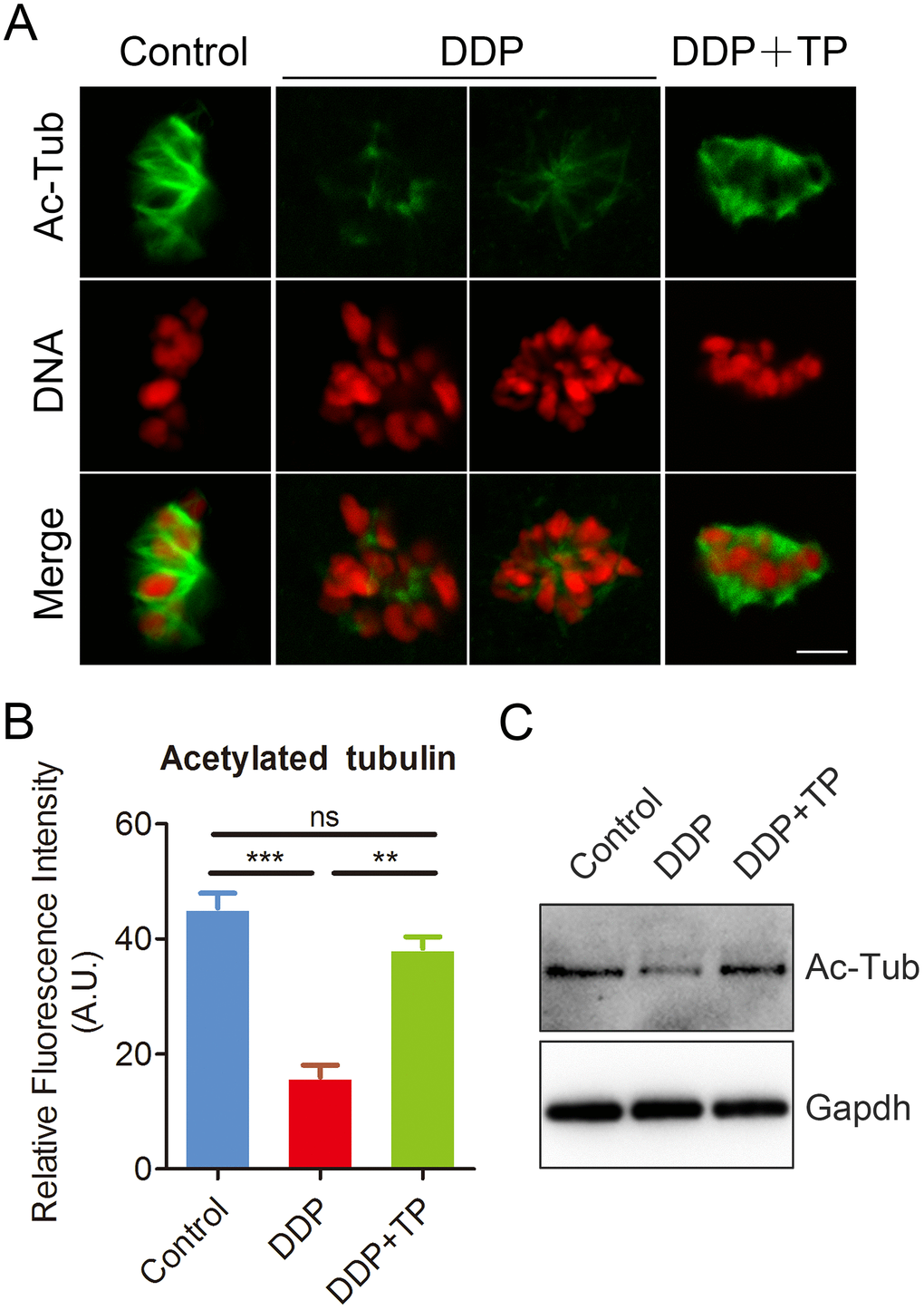 Effects of TP on the acetylation level of α-tubulin in DDP-exposed porcine oocytes. (A) Representative images of acetylated α-tubulin in control, DDP-exposed and TP-supplemented oocytes. Scale bar, 5 μm. (B) Quantitative analysis of the fluorescence intensity of acetylated α-tubulin in control, DDP-exposed and TP-supplemented oocytes. (C) The acetylation levels of α-tubulin were detected by Immunoblotting in control, DDP-exposed and TP-supplemented oocytes. The blots were probed with anti-acetyl-α-tubulin and anti-Gapdh antibodies, respectively. Data were presented as mean percentage (mean ± SEM) of at least three independent experiments. **P 