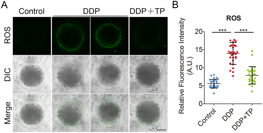 Effects of TP on the ROS level in DDP-exposed porcine oocytes. (A) Representative images of ROS levels in control, DDP-exposed and TP-supplemented oocytes. Scale bar, 35 μm (B) The fluorescence intensity of ROS in control, DDP-exposed and TP-supplemented oocytes were measured by the confocal microscopy using identical settings and parameters. Data were presented as mean percentage (mean ± SD) of at least three independent experiments. ***P 