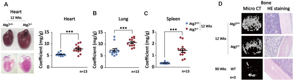 Multiple aging-like organ abnormalities in the Atg7-deleted mice in hematopoietic system. (A) Alteration of heart in morphology and size in the Atg7-deleted mice. Left panel, representative image of heart unstained (upper) and HE stained (down); right panel, heart/body weight ratio (coefficients) of the Atg7-deleted and wild-type mice. (B) Lung coefficients of the Atg7-deleted and wild-type mice. (C) Spleen coefficients of the Atg7-deleted and wild-type mice. (D) Alteration of bone mineral density. Upper, micro-CT analysis of bones of in the Atg7-deleted mice and the same-age wild-type mice as well as old wild-type mice; down, HE staining of bones from 12-week wild-type, Atg7-deleted, and old wild-type mice.