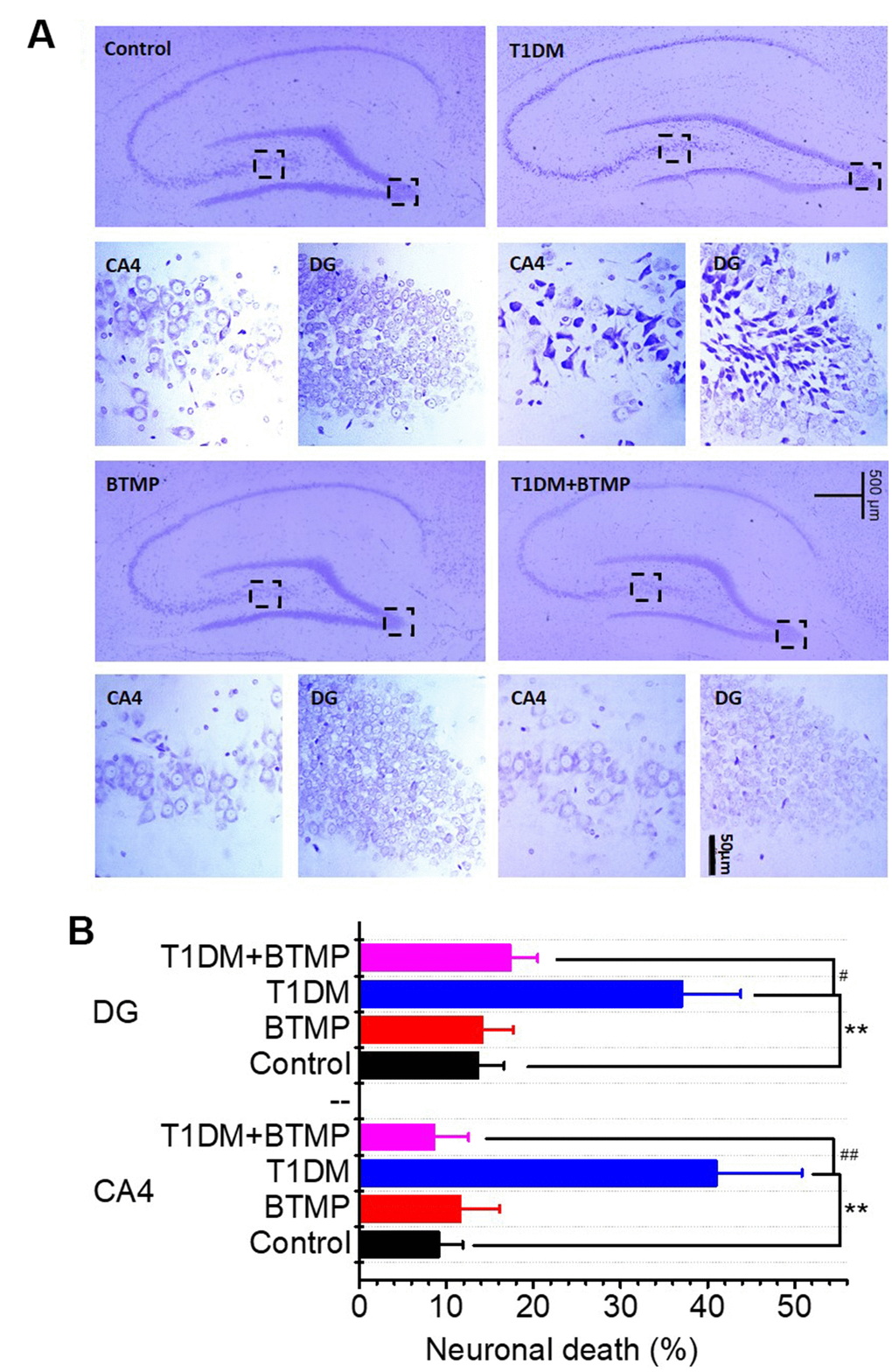 Nissl staining of hippocampal neurons of rats treated with BTMP. Animal groups and treatment were as described in Figure 2 except that hippocampal slices were prepared and stained with cresyl violet (panel A). Numbers of necrotic neurons were counted under a microscope as described in the Materials and Methods (panel B). The number of those groups are control (n=10), BTMP (n=9), T1DM (n=10) and T1DM+BTMP (n=10). All values are expressed as the mean ± S.E.M. “*” compared to the control group. “#” represents the difference between the T1DM and T1DM+BTMP groups. All values are expressed as the mean ± S.E.M. **, P P P 