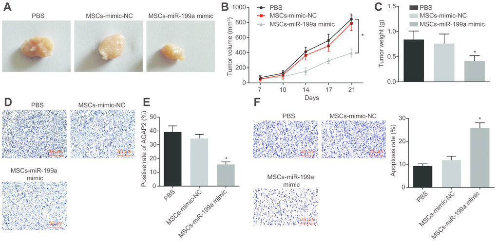 Combination of miR-199a treatment and hMSCs containing miR-199a inhibits tumor growth in vivo. (A) the tumor sizes in tumor-bearing nude mice after treatment with PBS, MSCs-mimic NC, MSCs-miR-199a mimic. (B) the tumor volume in tumor-bearing nude mice after treatment with PBS, MSCs-mimic NC, MSCs-miR-199a mimic. (C) the tumor weight in tumor-bearing nude mice after treatment with PBS, MSCs-mimic NC, MSCs-miR-199a mimic. (D–E) the changes of AGAP2 expression, detected by immunohistochemistry (Scale bar = 50 μM). (F) the apoptosis of glioma cells in tumor-bearing nude mice, detected by TUNEL staining (Scale bar = 25 μM). * p 