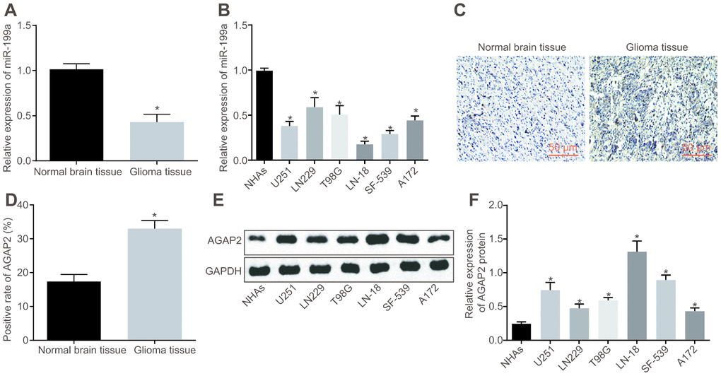 MiR-199a is poorly expressed, while AGAP2 highly expressed in glioma tissues and cell lines. (A) the expression of miR-199a in normal brain tissues and glioma tissues, determined by RT-qPCR. (B) the expression of miR-199a in NHAs and the glioma cell lines, determined by RT-qPCR. (C–D) the expression of AGAP2 in normal brain tissues and glioma tissues, detected by immunohistochemistry (200 ×). (E–F) the protein expression of AGAP2 in NHAs and different glioma cell lines, detected by Western blot analysis. * p t-test was used for the analysis in A and (D) One-way analysis of variance was used for other analyses. In tissues experiment, there were 75 glioma tissues and 17 normal brain tissues. The cell experiment was repeated three times.