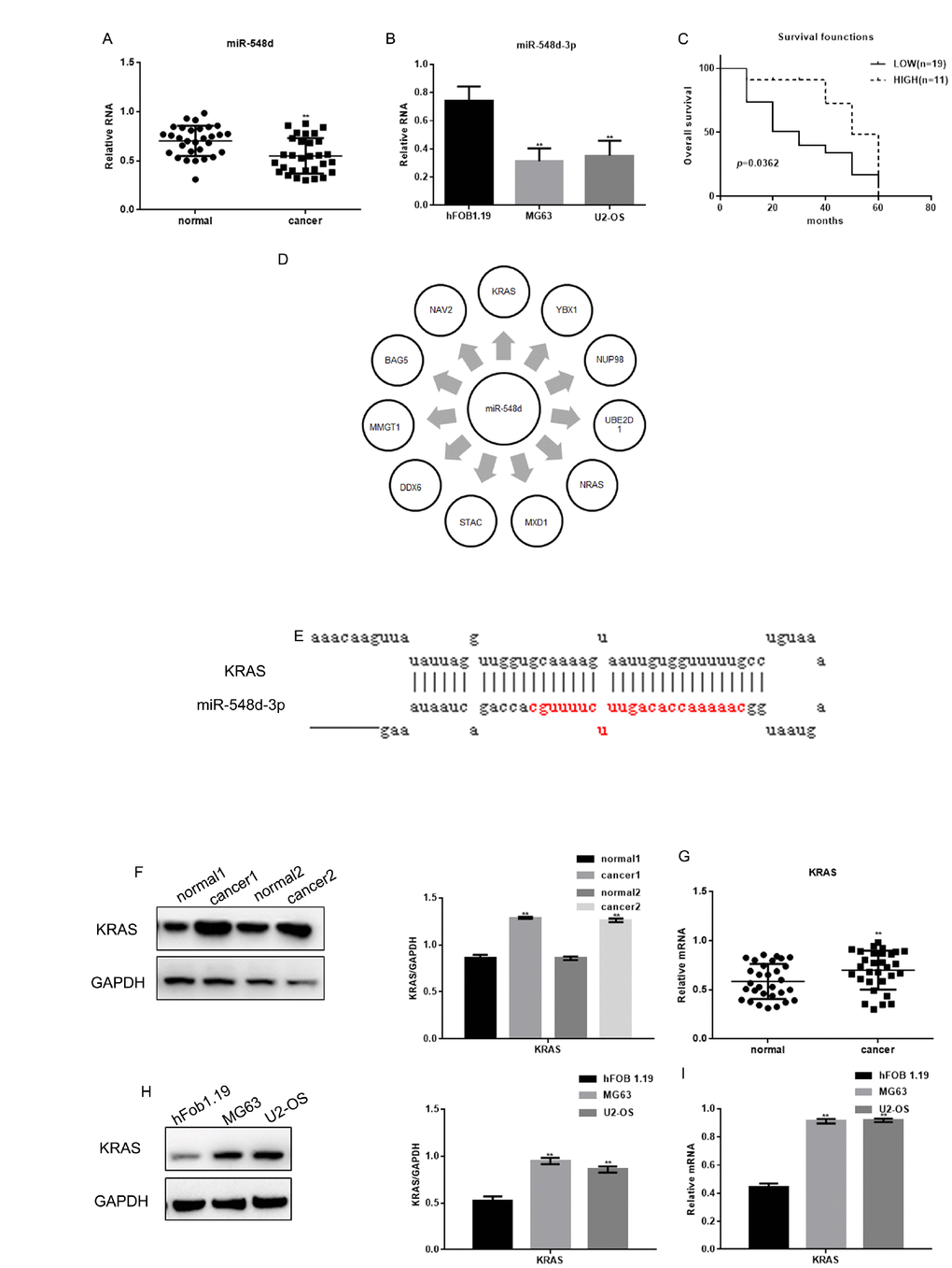 The expression of miR-548d-3p and KRAS in osteosarcoma. (A) The relative miR-548d-3p levels in 30 pairs of osteosarcoma tissues and adjacent normal tissues were detected by real-time PCR. Patients with lower miR-548d expression in their tumors than in mean of the normal. The results represent the mean±SD. **P B) Relative miR-548d-3p expression in cell lines (hFOB 1.19, MG63 and U2-OS). MG63 and U2-OS cells with lower miR-548d expression than hFOB 1.19 cells. The results represent the mean±SD of three independent experiments. **P C) The correlation between miR-548d-3p expression and patient survival. (D) Software analysis with miRDB revealed miR-548d-3p binding sites in a variety of genes. (E) The miRDB tool predicted that miR-548d-3p may bind to KRAS. (F) The relative KRAS levels in two pairs of osteosarcoma tissues and adjacent normal tissues were detected by Western blotting. The results represent the mean±SD. **P G) The relative KRAS levels in 30 pairs of osteosarcoma tissues and adjacent normal tissues were detected by Western blotting and real-time PCR. The results represent the mean±SD. **P H, I) The relative KRAS levels in cell lines (hFOB 1.19, MG63 and U2-OS) were detected by Western blotting and real-time PCR. The results represent the mean±SD of three independent experiments. **P 