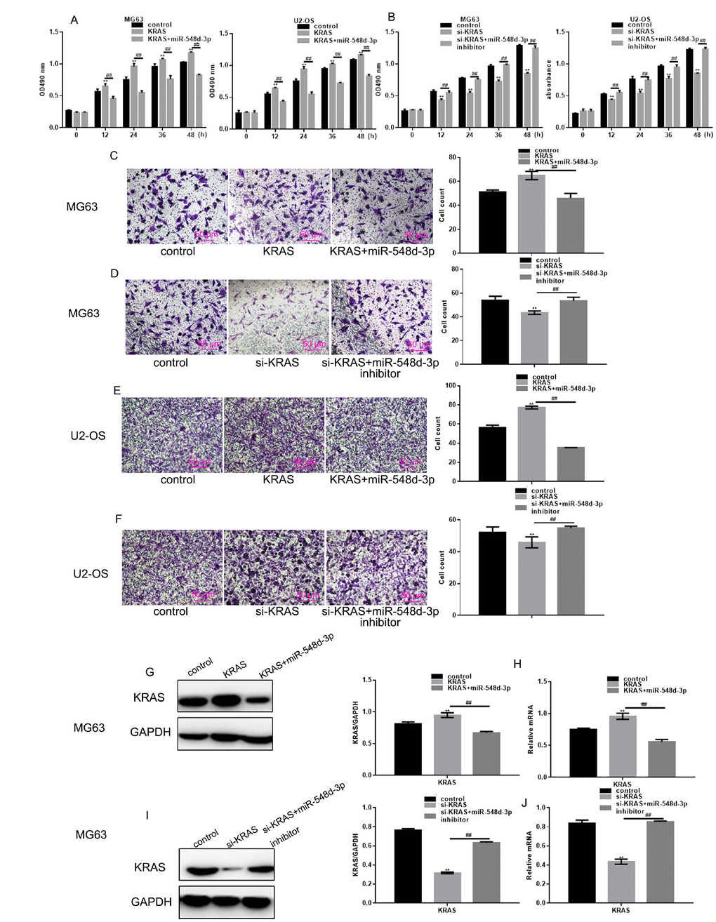 MiR-548d-3p inhibits the growth and migration of osteosarcoma cells by downregulating KRAS. (A) After transfection with KRAS overexpression vectors, cells were transfected with miR-548d-3p mimics or control miRNA. Cell growth was measured with an MTT assay after 24 h of transfection. The results represent the mean±SD of three independent experiments. **P P KRAS overexpression group. (B) After transfection with si-KRAS, cells were transfected with miR-548d-3p inhibitors or control miRNA. Cell growth was measured by an MTT assay after 24 h of transfection. The results represent the mean±SD of three independent experiments. **P P KRAS group or si-KRAS group. (C–F) Cell migration was measured with a Transwell assay after 24 h of transfection. The results represent the mean±SD of three independent experiments. **P P KRAS group or si-KRAS group. (G–N) The protein and mRNA levels of KRAS were measured in cells by Western blotting and real-time PCR, respectively. The results represent the mean±SD of three independent experiments. **P P KRAS group or si-KRAS group.