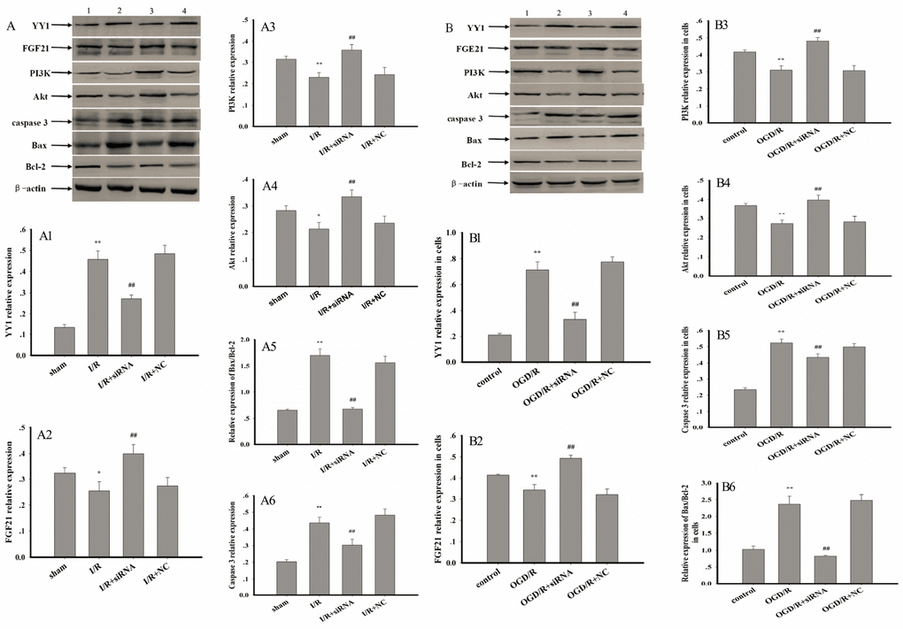 Effect of AK005401 on target proteins expressions. Mice and HT22 cells were used to establish I/R model and OGD/R model, respectively. The expression levels of YY1, FGF21, PI3K, Akt, caspase 3, Bcl-2, and Bax were visualized using chemiluminescence method. As shown in Figure 6, (A) represents Western blots in panel (1, 2, 3, and 4 represent sham, I/R, AK005401siRNA, and NC, respectively). (A1–A6) represent the relative expressions of YY1, FGF21, PI3K, Akt, caspase 3, and the relative ratio of Bax/Bcl-2 in hippocampus tissue, respectively. As shown in Figure 6-2, (B) represents Western blots in panel (1, 2, 3, and 4 represent control, OGD/R, AKsiRNA, and NC, respectively). (B1–B6) represent the relative expressions of YY1, FGF21, PI3K, Akt, caspase 3, and the relative ratio of Bax/Bcl-2 in HT22 cells, respectively. Data were presented as mean±SD (n = 3). One-way ANOVA test was used to determine statistical significance. *P **P ##P 