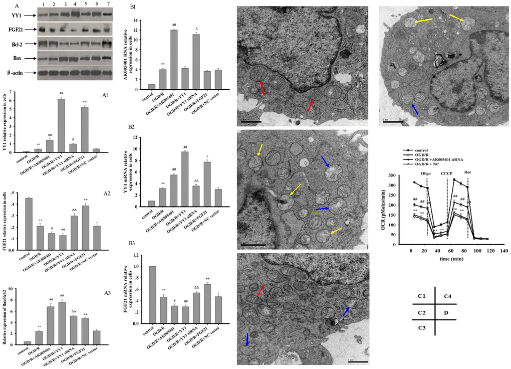 Effect of overexpression of AK005401 and YY1 on the expressions of target genes and proteins and effect of AK005401 on mitochondrial structure and cell respiration. HT22 cells were seeded in 96-well and 6-well plates and divided in seven groups for expression of target genes and proteins (control, OGD/R, OGD/R+AK005401, OGD/R+YY1, OGD/R+YY1 siRNA, OGD/R+FGF21 and OGD/R+NC vector) or four groups for cell respiration (control, OGD/R, AK005401siRNA, and NC). A represents Western blots in panel (1, 2, 3, 4,5,6 and 7 represent control, OGD/R, OGD/R+AK005401, OGD/R+YY1, OGD/R+YY1 siRNA, OGD/R+FGF21 and OGD/R+NC vector, respectively). (A1–A3) represent the relative expressions of YY1, FGF21and the relative ratio of Bax/Bcl-2 in cells, respectively. (B1–B3) represent represent the expression levels of AK005401, YY1 and FGF21 in HT22 cells, respectively. (C1–C4) represent mitochondria structure of control group, OGD/R group, AK005401siRNA group, and NC group, respectively, by using a transmission electron microscope (×20,000 magnification). Transmission electron microscope shows normal mitochondrial structure (red solid line arrows) and pathological mitochondria with irregular shape, as well as swollen (blue solid line arrow) and vesicular mitochondrial clusters (yellow solid line arrow). (D) represents mitochondrial oxygen consumption rate (OCR) of different groups. OCR was measured using an Oxygraph-2k system (n = 3 experiments per condition). Data were presented as mean±SD (n = 3). One-way ANOVA test was used to determine statistical significance. **P #P ##P ΔP ΔΔP +P ++P 