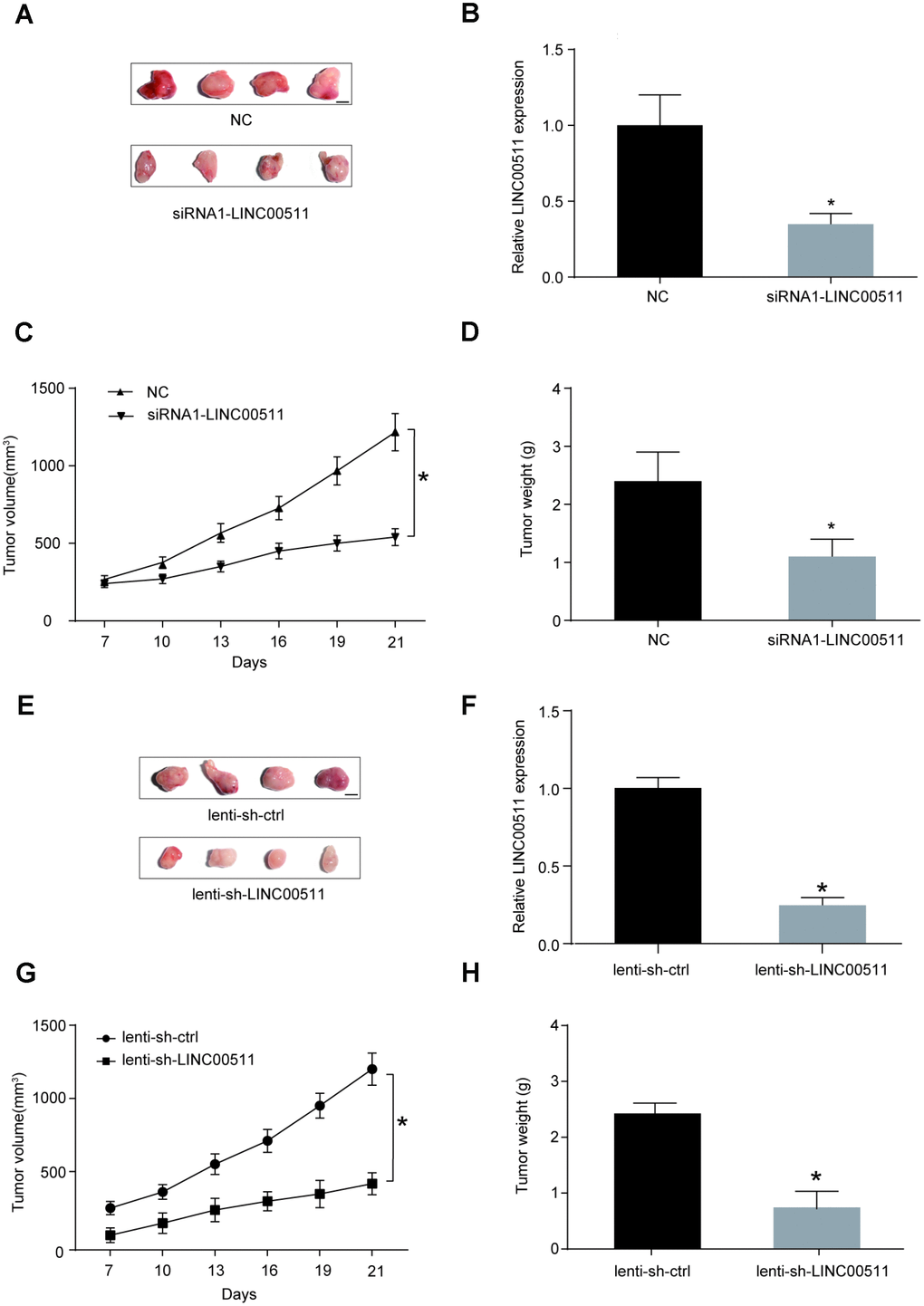 LINC00511 promotes the tumorigenesis of OS in nude mice. (A) Xenografts formed by HOS cells with normal (upper) or downregulated (bottom) expression of LINC00511. Tumor tissues were harvested after 3 weeks of implantation (Scale bar, 0.5 cm). (B) Expression level of LINC00511 in the xenografts tissues. *PC–D) SiRNA-induced downregulation of LINC00511 inhibited the growth of xenografts in nude mice. The volumes of xenografts were measured every 3 days, and their weights were measured after harvesting. (E) Xenografts formed by HOS cells with normal (upper) or downregulated (bottom) expression of LINC00511. Tumor tissues were harvested after 3 weeks of implantation (Scale bar, 0.5 cm). Lenti-sh-LINC00511 cells were transfected with lentivirus-mediated shRNA targeting LINC00511. Lenti-sh-ctrl means cells were transfected with shRNA lentiviral particles with nontargeting scrambled shRNA sequences. (F) The LINC00511 expression level in lenti-sh-LINC00511 group was markedly decreased compared to that in the lenti-sh-ctrl group. (G–H) ShRNA-induced downregulation of LINC00511 inhibited the growth of xenografts in nude mice. The volumes of xenografts were measured every 3 days, and their weights were measured after harvesting. *P