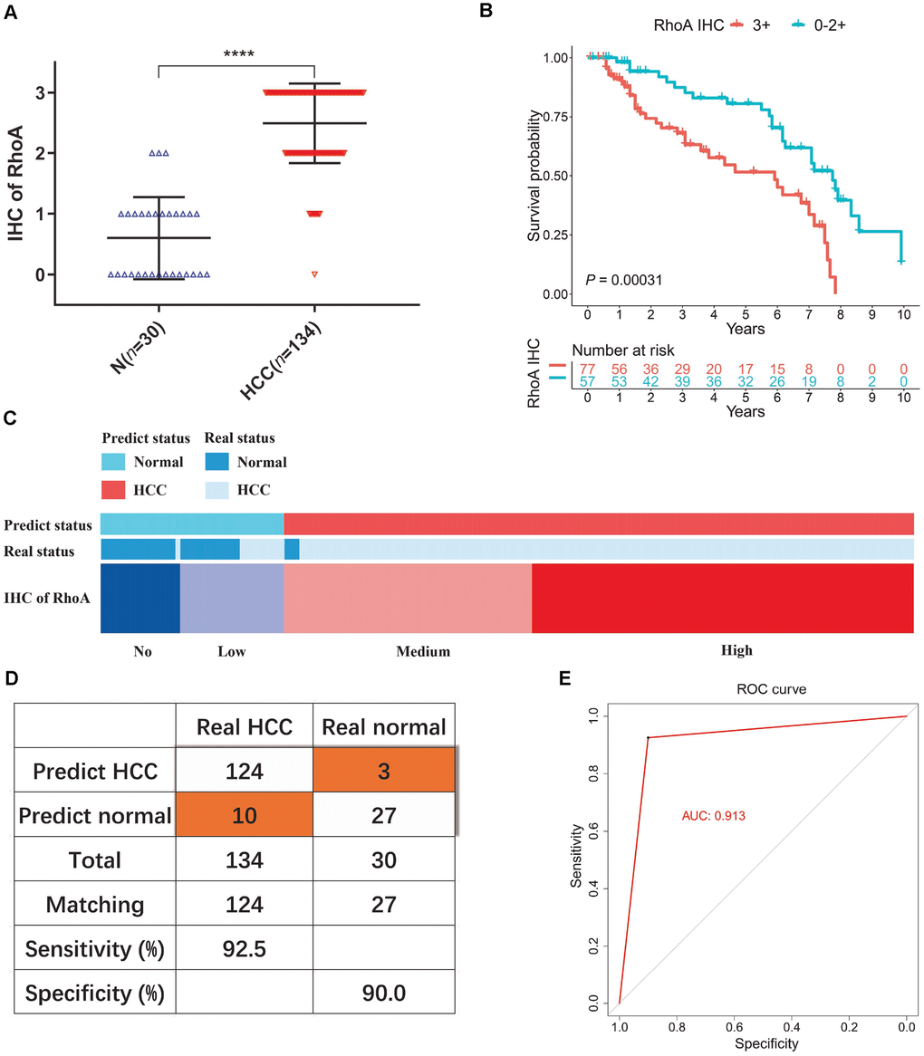 Diagnostic model of RhoA protein expression in liver cancer patients. The staining intensities of RhoA via immunohistochemistry chips from PUMCH patient samples (A). Kaplan-Meier curves of overall survival (B) of liver cancer patients with high RhoA protein expression levels (3+) and low RhoA protein expression levels (0–2+). Diagram (C), sensitivity and specificity validation (D) and receiver operating characteristic curve (E) of the diagnostic model according to RhoA immunohistochemistry level.