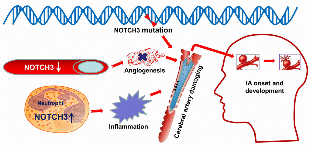 Schematic illustrating a possible role for NOTCH3 in IA. NOTCH3 is altered at the genetic polymorphisms which were predicted to alter an amino acid residue and therefore potentially the protein structure. Down-regulated expression of NOTCH3 in the cerebral artery influences angiogenesis damaging cerebrovascular endothelial repair. Up-regulated expression of NOTCH3 in neutrophil activate and promote inflammation in the cerebral artery. In a word, these abnormities in NOTCH3 cause damage to blood vessels in the brain, which can lead to the onset and development of intracranial aneurysm. Image modified from ScienceSlides (VisiScience Corp., North Carolina, USA).