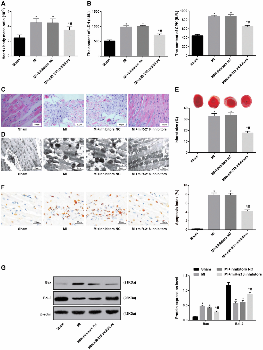 Downregulated miR-218 expression alleviates pathological damage of cardiac tissues in MI rat models. (A) the ratio of heart to body weight, n = 6; (B) serum levels of LDH and CPK examined by the biochemical analyzer, n = 6; (C) HE staining showing pathological changes of cardiac tissues (× 200), n = 3; (D) ultrastructure of cardiomyocytes observed by transmission electron microscope (× 5000), n = 3; (E) TTC staining showing the infarct size of rats, n = 3; (F) TUNEL staining showing the apoptotic index of cardiomyocytes (× 400), n = 3; (G) Western blot assay showing protein levels of apoptosis-related factors Bax and Bcl-2 in cardiac tissues, n = 3; *versus the sham group, P P 