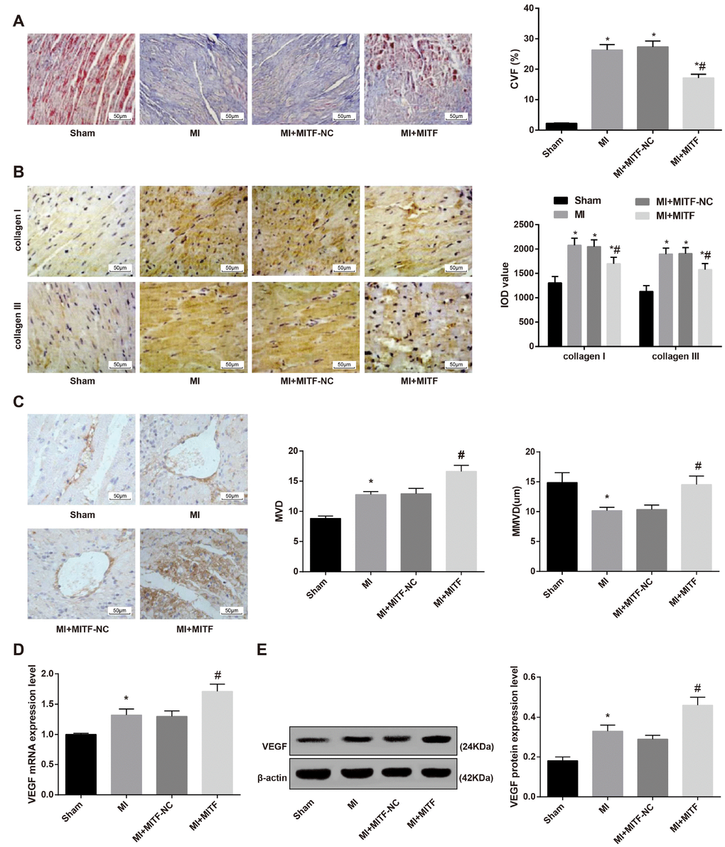 Upregulated MITF expression reduces cardiac fibrosis and promotes angiogenesis in MI rats. (A) Masson staining showing the cardiac fibrosis of rats (× 200); (B) immunohistochemical staining showing the expression of type I collagen and type III collagen (× 200); (C) MVD and MMVD of cardiac tissues; (D) the mRNA expression of angiogenesis-related factor VEGF detected by RT-qPCR; (E) the protein expression of angiogenesis-related factor VEGF detected by western blot assay. * versus the sham group, P P 