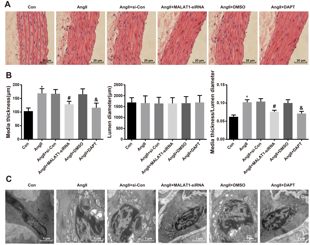 Down-regulated MALAT1 and inhibited Notch-1 relieve pathological lesion of thoracic aorta. (A) thoracic aorta tissues of rats were observed using HE staining (× 500, scale bar: 20 μm); (B) medial thickness and lumen diameter in thoracic aorta of rats and their ratio; (C) ultrastructure of thoracic aorta of rats were observed by a transmission electron microscopy (× 10000, scale bar: 1 μm). * P vs the Con group; # P vs the AngII + si-Con group; & P vs the AngII + DMSO group; n = 10, data were expressed as mean ± standard deviation; one-way ANOVA was used for analyzing data, pairwise comparison was analyzed by Tukey’s post hoc test.