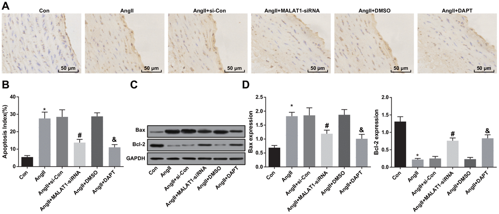 Down-regulated MALAT1 and inhibited Notch-1 suppress apoptosis of aortic endothelial cells. (A) endothelial cells of thoracic aorta were observed by TUNEL staining (× 200, scale bar: 50 μm); (B) apoptosis index of endothelial cells in thoracic aorta; (C) protein bands of Bax and Bcl-2 of thoracic aorta tissues; (D) expression of Bax and Bcl-2 in thoracic aorta; * P vs the Con group; # P vs the AngII + si-Con group; & P vs the AngII + DMSO group; n = 10, data were expressed as mean ± standard deviation; one-way ANOVA was used for analyzing data, pairwise comparison was analyzed by Tukey’s post hoc test.