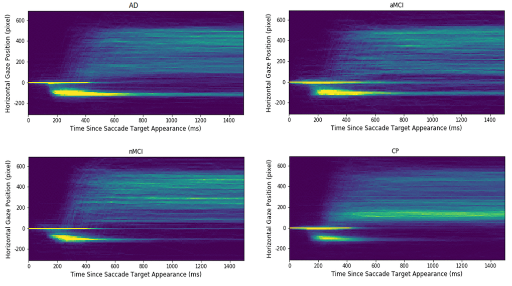 Heatmap plots of the extracted gaze signals in each of participant groups. The x-axis indicates the time since saccadic target appearance, and the y-axis presents the aligned horizontal gaze position. The warmer the colour; the higher is the gaze point density in the corresponding spatial-temporal location. Note that the longest "comet" tails, reflecting a high proportion of uncorrected errors, are evident for the Alzheimer's (AD) and the amnesic Mild Cognitive Impairment (aMCI) groups. The control participants (CP) and the non- amnesic MCI have distinctly shorter "comet" tails.