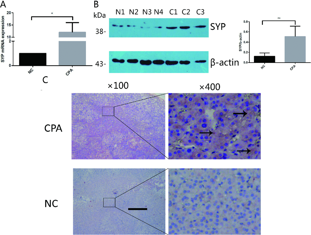 The expression of SYP in CPA. (A and B) The relative mRNA levels of SYP determined by real-time PCR (A) and protein levels of SYP determined by Western blotting (B) in CPAs and normal adrenal tissues (n=12). (C) Immunohistochemisty staining determines the expression of SYP in CPAs and normal adrenal tissues. The brown area indicated by arrow is the positive staining of SYP in CPAs. Three independent experiments were performed, and representative data are shown. The data represent the mean ± SD. NC, normal control. **p